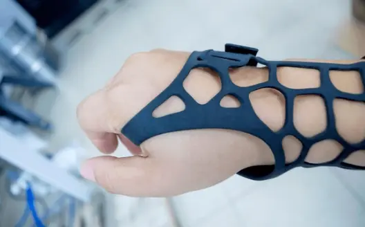 Favism3D: Impresión 3D con filamento ASA para prototipos duraderos y piezas de alto rendimiento en entornos exigentes. Ortesis de mano impresa en 3D con filamento ASA negro, ideal para prototipos funcionales y aplicaciones exigentes.